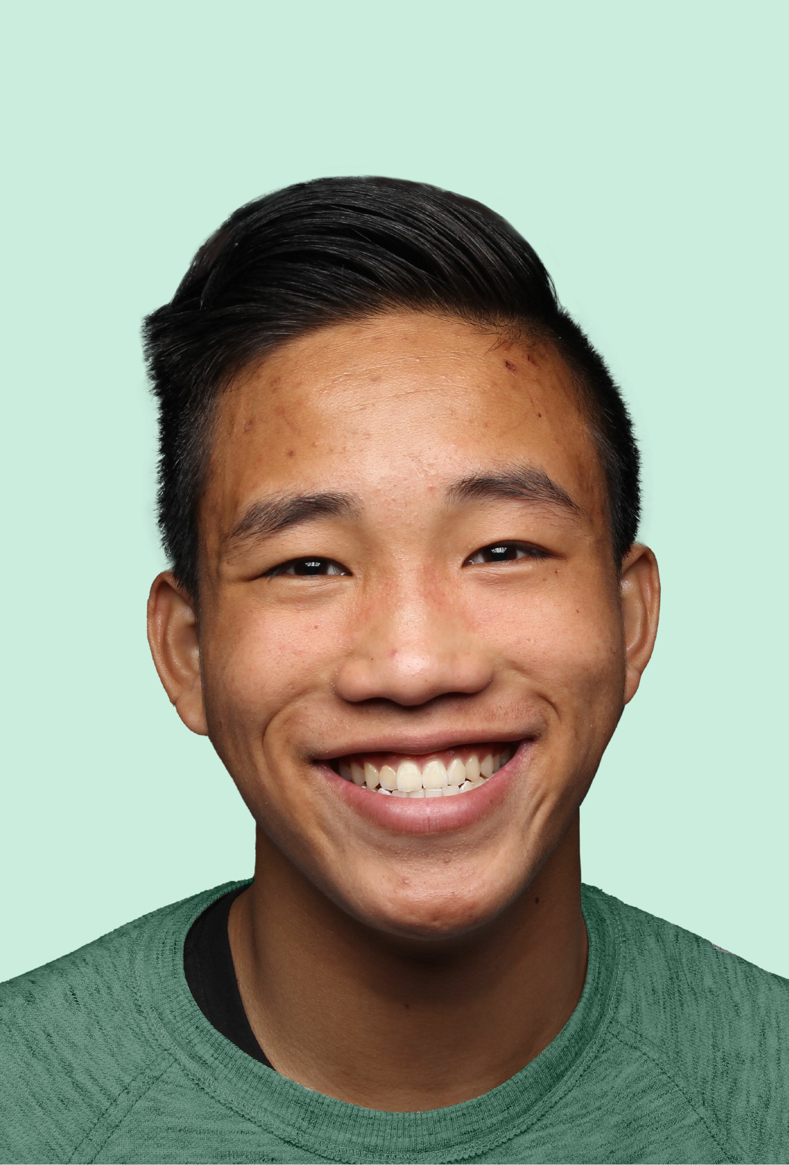 Older male teen with visible acne confidently smiling at camera.